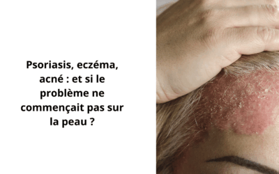 Psoriasis, eczéma, acné : parasites, foie et inflammation chronique